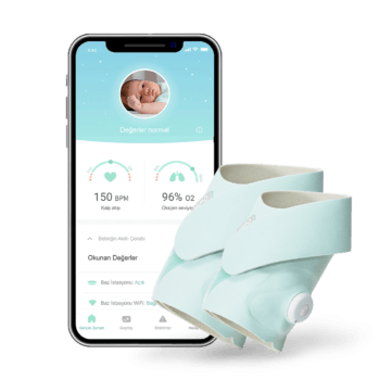 Alternative view of Owlet Smart Sock  – Bebeğinizin Sağlığını Anlık Takip Eden Akıllı Çorap